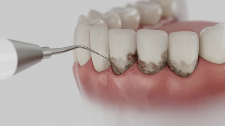 Reliable Dental contractor in Aitkin, MN by Smile Center Dentistry
